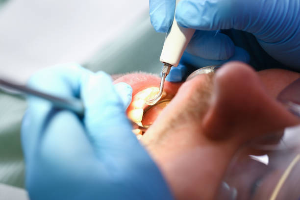 Best Mobile Emergency Dentist in Cherryville, PA