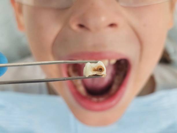 Best Weekend Emergency Dentist in Cherryville, PA